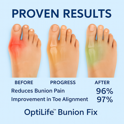 Bunion™ Fix