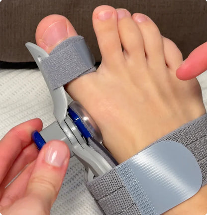 Bunion™ Fix